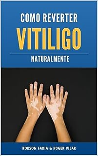 Livro Reverter Vitiligo Naturalmente (o inovador programa de um brasileiro que curou vitiligo tendo apenas 15 anos de idade) 100% natural e 100% comprovado)