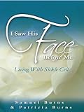 I Saw His Face Before Me: Living with Sickle Cell Anemia by Samuel Burns, Patricia Burns