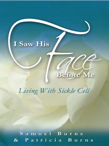 I Saw His Face Before Me: Living with Sickle Cell Anemia by Samuel Burns