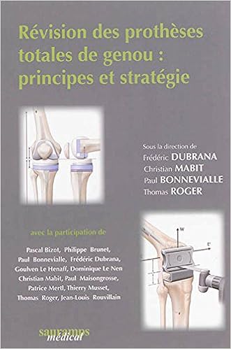 Amazonfr Révision Des Prothèses Totales Du Genou - 