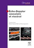 Echo-doppler Vasculaire Et Viscéral (French Edition) by Marie-France Bellin, Elsevier-masson