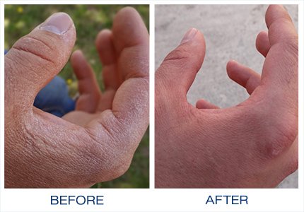 Gloves in a Bottle Shielding Lotion Great for Dry Itchy Skin, Grease-Less and Fragrance Free, 2 oz./60 mL, Pack of 3