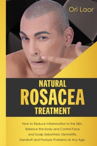Natural Rosacea Treatment: How to Reduce Inflammation in the Skin, Balance the body and Control Face and Scalp Seborrheic Dermatitis, Dandruff and Psoriasis Problems at Any Age.: Volume 3 (Anti Aging)