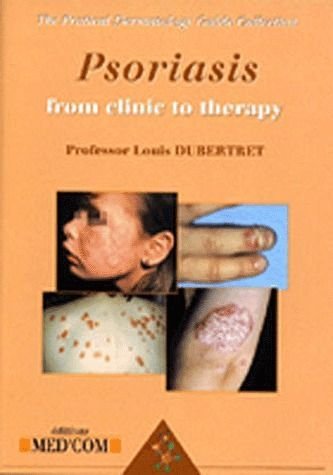 Psoriasis