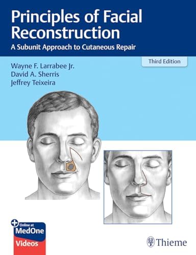 Surgical Approaches to the Facial Skeleton: 9781496380418