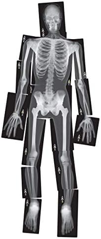 Roylco True To Life Human X-Rays
