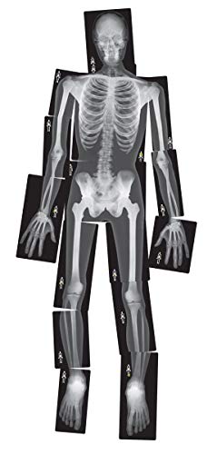 Roylco True To Life Human X-Rays