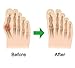 Bunion Corrector,Bunion Splint,Gel Bunion Pads for Foot Health Care,Toe Separators Spacers Straighteners-Relief Pain in Hallux Vagus,Big Toe,Tailors Bunion.Big Toe Joint.