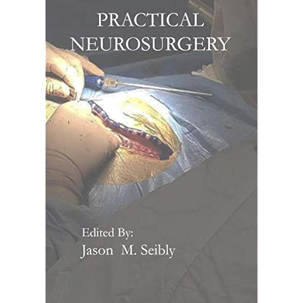 Vitreous Microsurgery: 9781975168353: Medicine & Health Science