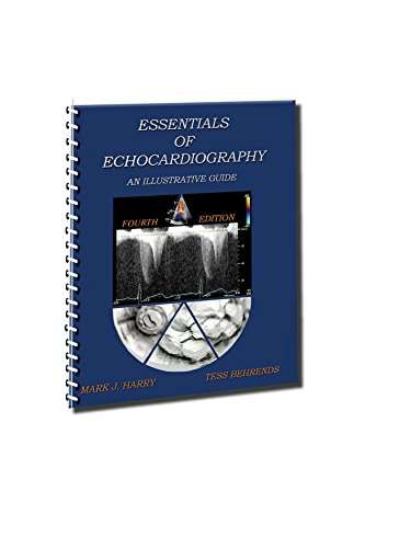 Essentials Of Echocardiography