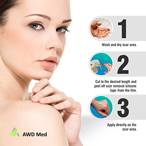 AWD Medical Grade Soft Silicone Gel Tape for Scar Removal (1.6” x 60”) Highly Comfortable