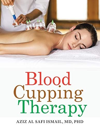 Blood Cupping Therapy