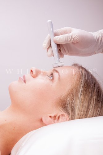 1 0mm Dermastamp White Lotus The Best All Round Skin Needling