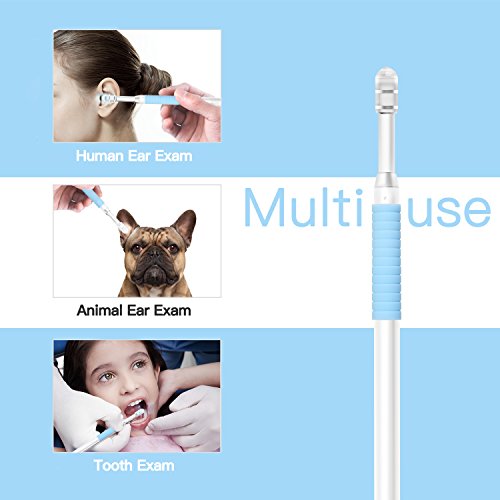 Ear Otoscope,TryAce 1.3MP 720P HD Ear Scope Inspection Camera 3 In 1 USB Ear Digital Endoscope Earwax Cleansing Tool with 6 Leds for Micro USB,USB-C Android Phone,Windows MAC PC - Thumbnail 3