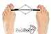 PediDoc Bunion Corrector Bunion Toe Straightener – Bunion Relief Big Toe Strap Bunion Splint Restores Natural Alignment of Overlapping and Crooked Toes – Big Toe Spacer and Toe Stretcher