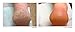 TrueLipids Moisturizing Cream & Ointment for Dry Cracked Hands & Feet