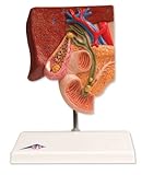 3B Scientific Gallstone Model