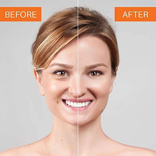 Anti-Aging Serum with Vitamin C, E, Ferulic Acid – Helps Strengthen, Brighten, Tighten, Smooth Skin Dark Spot Corrector for Face, Daily by Mer Rouge, 1 Fl. Oz.