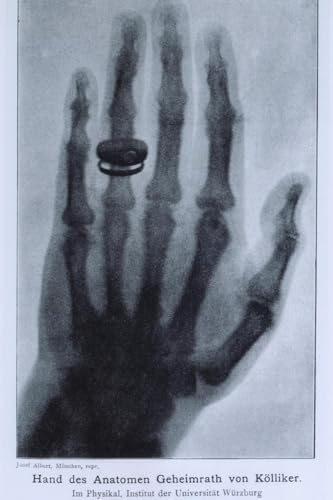 ART.COM Wall Art Print Konrad Roentgen's X-Ray of the Hand of Showing Bones and…