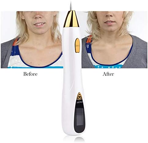 Picosecond Pen, Skin Tag Repair Kit 9-Speed Adjustable Electric Facial Beauty Equipment Repair Freckles/Tattoo / Mole/Wart / Dark Mark, Portable Skin Care Beauty Tools (Unisex)