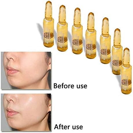 htfrgeds 7PC PURE VITAMIN C SERUM FOR FACE 20% With Hyaluronic Acid - Anti Wrinkle, Anti Aging, Dark Circles, Age Spots, Vitamin C 2ml