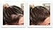 FEBRON Hair Fibers For Thinning Hair LIGHT BROWN Giant 30G For Women & Men Hair Loss Concealer Hair Powder Volumizing Based 100% Undetectable & Natural - Bald Spots Filler
