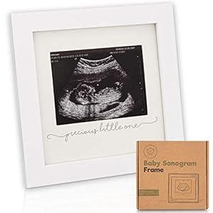 Baby Sonogram Picture Frame – Modern Ultrasound Frame For Mom To Be – Pregnancy Announcement Sonogram Photo Frames…