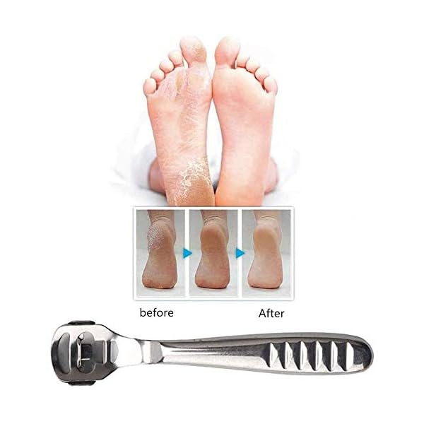 zukabmw-Pedicure-Callus-Shaver-Foot-File-Care-Hard-Skin-Remover-Callus-Shaver-Sets-with-Case-Foot-File-Heads-10-Replacement-Blade-for-Hand-Feet zukabmw Pedicure Callus Shaver Foot File Care Hard Skin Remover Callus Shaver Sets with Case, Foot File Heads & 10…