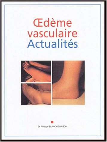 Amazon Fr Oedeme Vasculaire Actualites Blanchemaison Philippe Livres