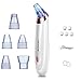 Blackhead Remover Pore Vacuum Suction Pimple Extractor Comedone Removal Tool，USB Electric Rechargeable Facial Skin Peeling Cleanser Microdermabrasion Exfoliating Machine 5 In 1 by Alferdo