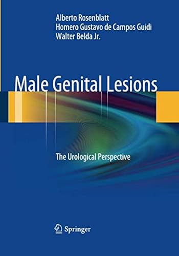 Download Male Genital Lesions: The Urological Perspective PDF