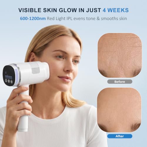 NALONE 22J Pulsed Light Epilator Touch Screen, 4-IN-1 Definitive Laser Hair Removal -HR/SC/RA/BT, 10 Levels Home Women & Men, Face, Body, Armpits