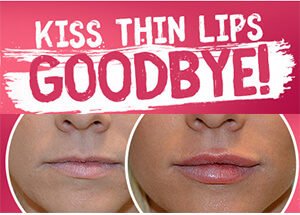 apex plump premium collagen lip plumper lip enhancer instant plumping lip treatment fuller lips lip filler lip inj froourhouse com