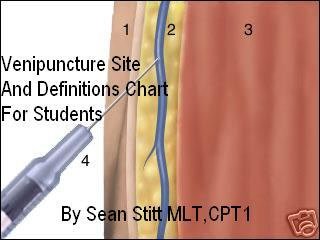 Phlebotomy Draw Site And Definitions Chart For Students Sean