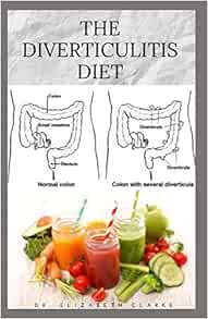 THE DIVERTICULITIS DIET Easy Diet Guide for People with Diverticulitis 