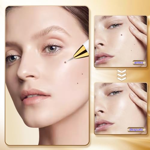 Plasma Pen Dispositivo de Belleza Para La Eliminación de Imperfecciones Comunes de la Piel con pantalla LED. 10 niveles de intensidad de Intend Ajustables. 1 Gruesa y 10 s Finas san valentín regalos