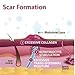 EpiDerm Long Strips Natural Silicone Scar Sheets – Soft, Flexible & Reusable Scar Sheets - Scar Treatment for Tummy Tuck, C-Section & Surgery Scars - Conforms to Body Contours - 1.4
