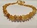 17 Inch Arthritis, carpal tunnel Raw UnPolished Milk white & lemon yellow adult Baltic Essentials Amber Therapeutic Necklace. Soothing with safety Screw Clasp. Anti-inflammatory, Reduction of swelling.