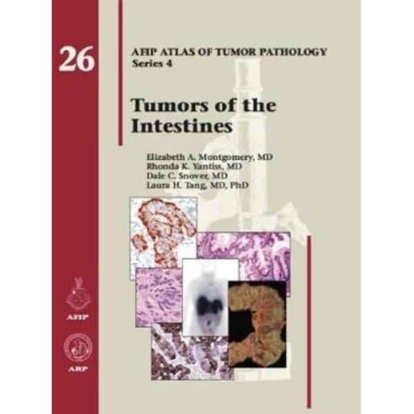 AFIP　Tumors of the Pancreas 【新品】 Tumors of the Pancreas (Afip Atlas of Tumor Pathology; 4th Series