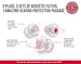 EarPeace Concert Ear Plugs - Reusable High Fidelity Earplugs - Hearing Protection for Music Festivals, DJs, Musicians, Motorcycles, Raves, Work & Airplane Noise Reduction (Red Case - Standard Plugs)