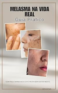 Livro MELASMA NA VIDA REAL: Como tratar melasma e clarear manchas de forma segura, eficaz e sem gastar dinheiro à toa