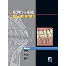 Specialty Imaging: Dental Implants, 1e