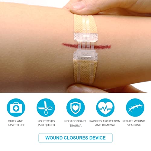 Emergency Wound Closure Device, Sutures Bandaids Kit 2 Pcs Repair