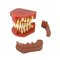 Dayloveme Anatomy Model,Dental Children Removable Deciduous Teeth Model Permanent Tooth Alternative Display Studying Teaching Tool