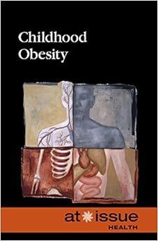 Childhood Obesity (At Issue) Childhood Obesity (At Issue)