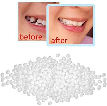 Temporary Tooth Repair Kit by Fullwei - Vampire Teeth Adhesive Glue -Broken Teeth and Gaps FalseTeeth Solid Glue Denture Adhesive (25g)