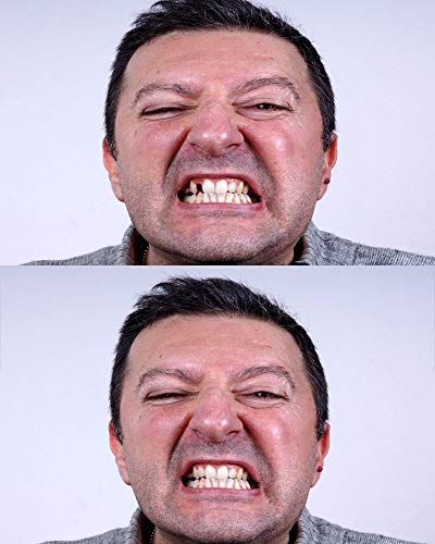 2 Amazing+Temporary+Tooth+Complete+Replacement