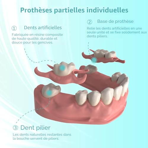 Custom Partial Dental Denture - Temporary Denture, Removable and Temporary Denture. Perfect fit and easy to use to recreate your smile at home (6 teeth)