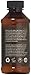 Organic Face Toner - Apple Cider Vinegar Natural Acne Treatment - Clear Blemishes, Unclog Pores, Reduce Redness - Facial Cleanser & Moisturizer - pH Balance Dry, Oily & Combination Skin - 4 oz RESTOAR