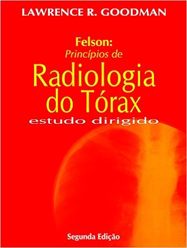 felson radiologia do torax felson radiologia do torax